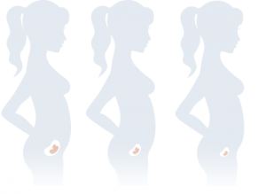 ectopic pregnancy treatment services in sharjah